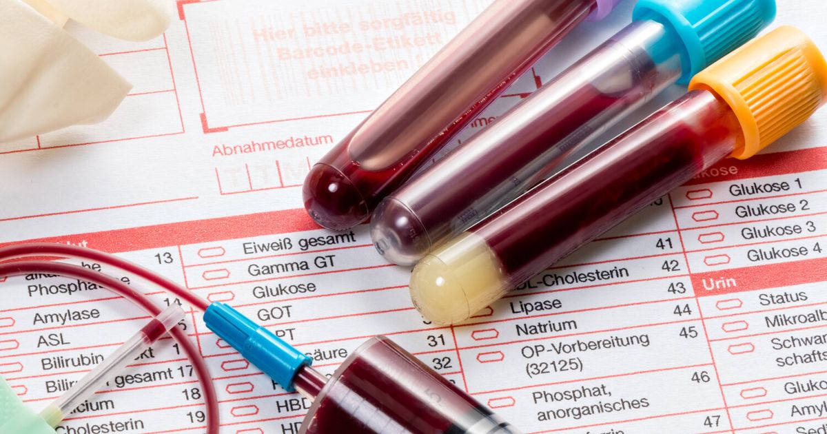 Innsbrucker-verstarb-pl-tzlich-Ein-r-tselhafter-Wunsch-und-die-Antwort-der-Gerichtsmedizin