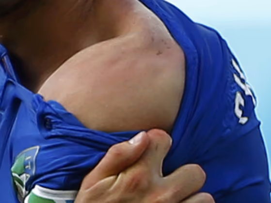 Suarez-Opfer Giorgio Chiellini zeigte nach der Attacke seine Bisswunde.