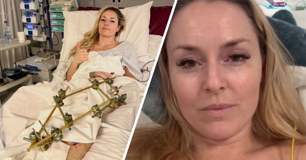 Vonn-meldet-sich-mit-Video-Botschaft-aus-dem-Krankenhaus-Morgen-n-chste-Operation-