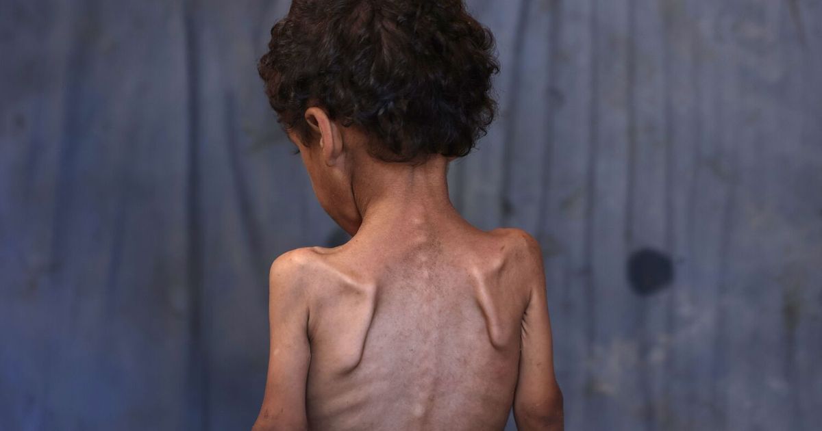 Lage-in-Gaza-Im-Abgrund-der-Entmenschlichung