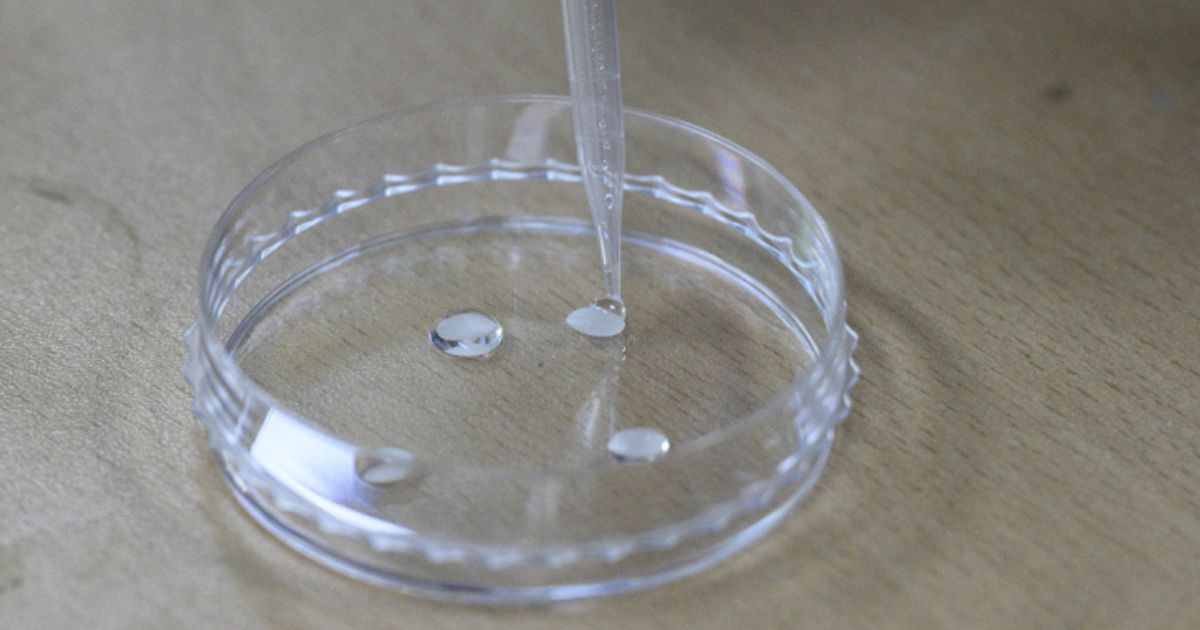 Resistenztest-bei-Harnwegsinfektion-binnen-sechs-Stunden