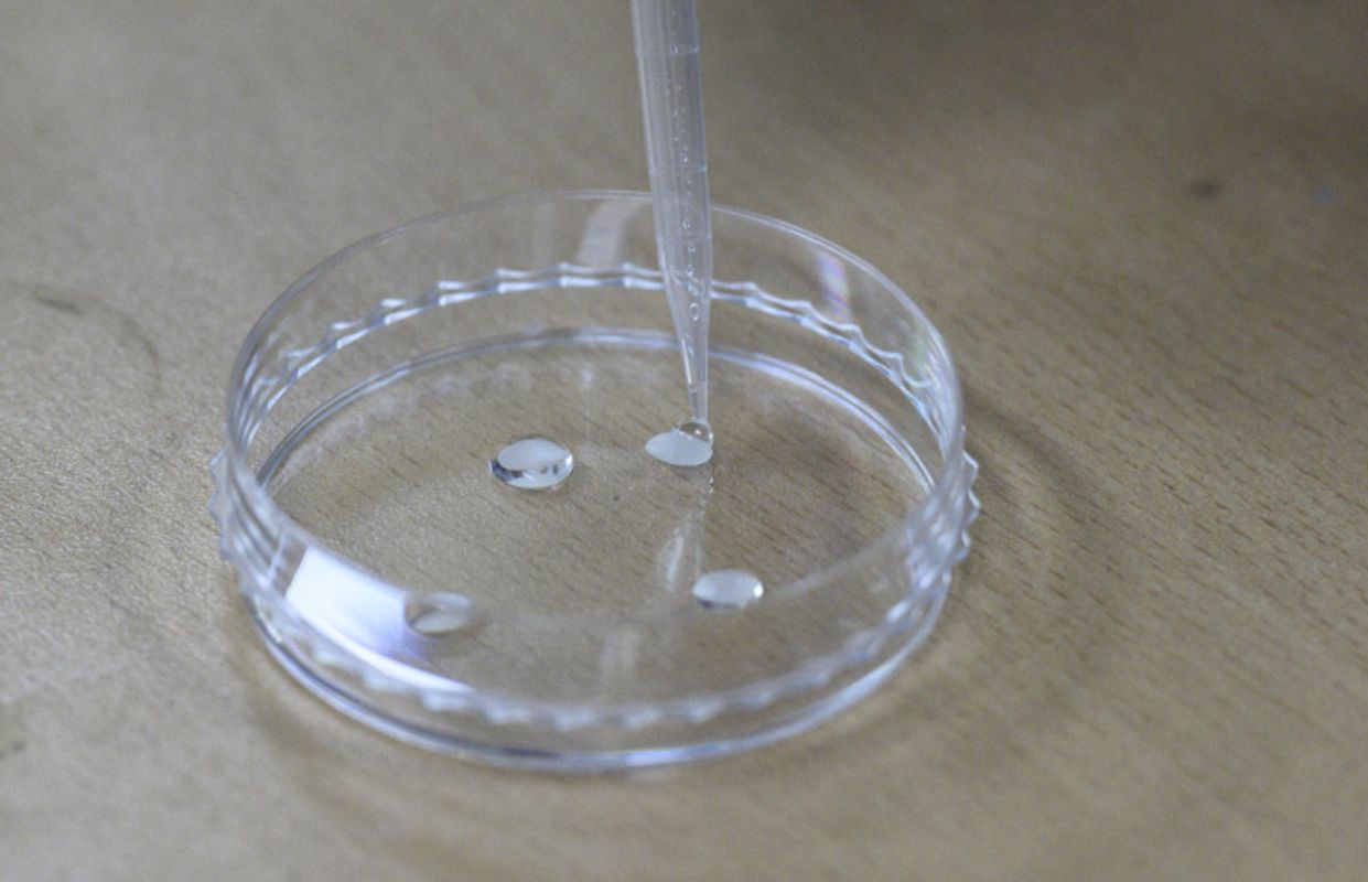 Resistenztest bei Harnwegsinfektion binnen sechs Stunden