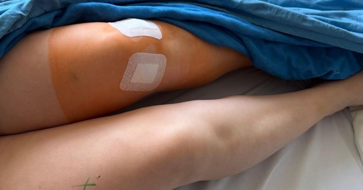 Beine-bei-Knie-OP-verwechselt-So-reagiert-die-Tiroler-Patientin-nach-dem-Vorfall-an-der-Klinik