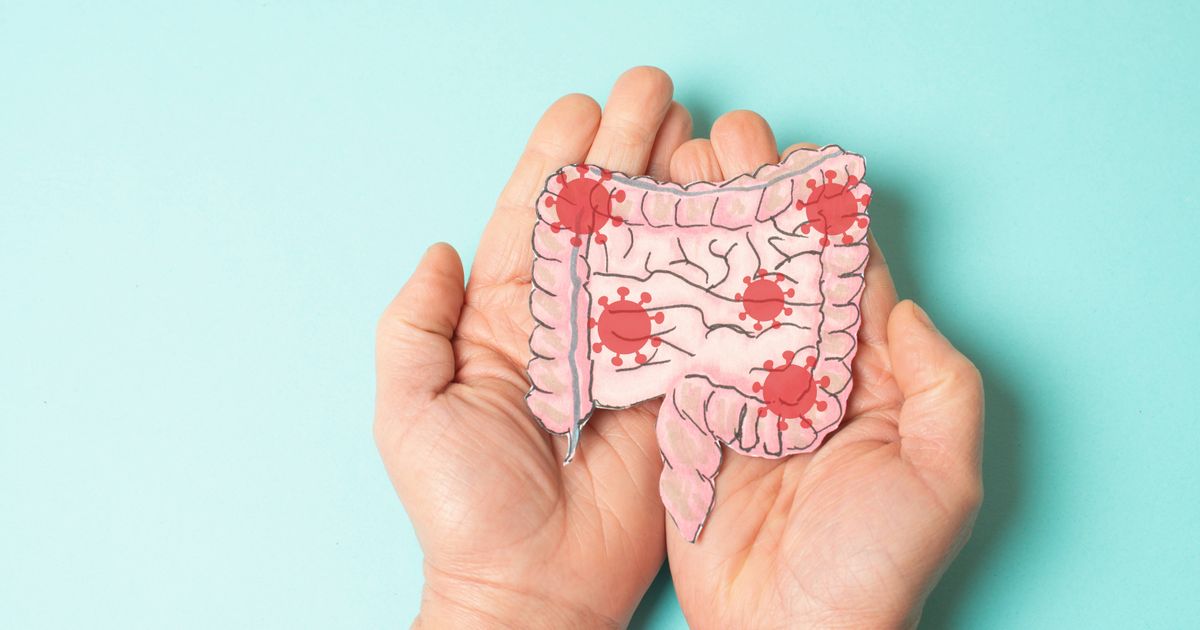 Rund-4000-TirolerInnen-von-chronisch-entz-ndlicher-Darmerkrankung-betroffen