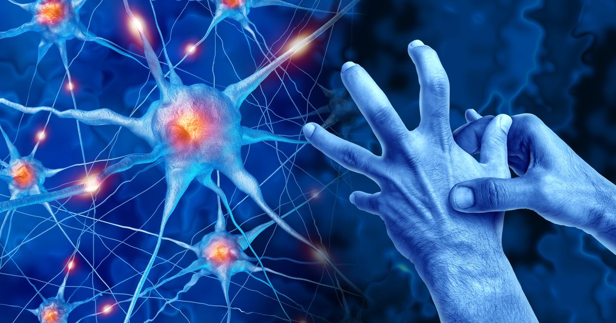 Wie-man-jetzt-fr-her-erkennen-k-nnte-ob-man-an-Parkinson-erkrankt-ist