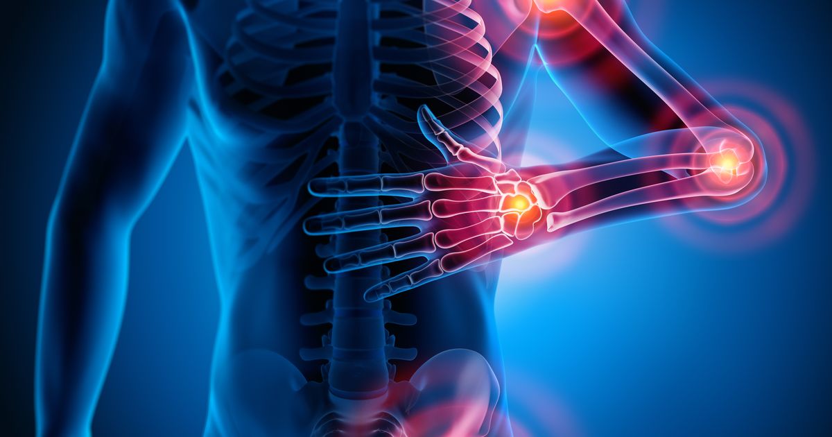 Netzwerk-CHRONISCH-l-dt-ein-Immunerkrankungen-und-Rheuma-im-Fokus