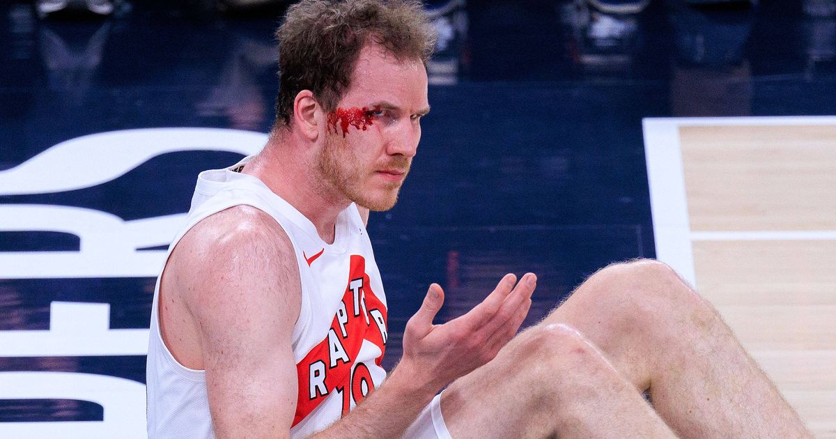 P-ltl-erlitt-Cut-bei-Toronto-Niederlage-sterreichs-NBA-Star-musste-gen-ht-werden