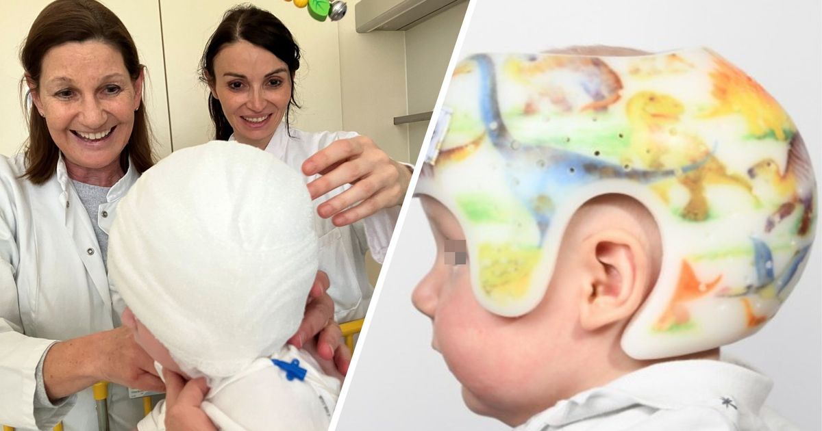 Zu-lang-zu-schmal-zu-spitz-Wenn-die-Kopfform-des-Babys-nicht-der-Norm-entspricht