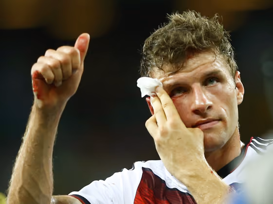 Deutschland kam gegen Ghana mit einem blauen Auge davon. Die Elf von Joachim Löw erkämpfte sich ein 2:2-Unentschieden. Thomas Müller schied mit einer Platzwunde am rechten Auge verletzt aus.