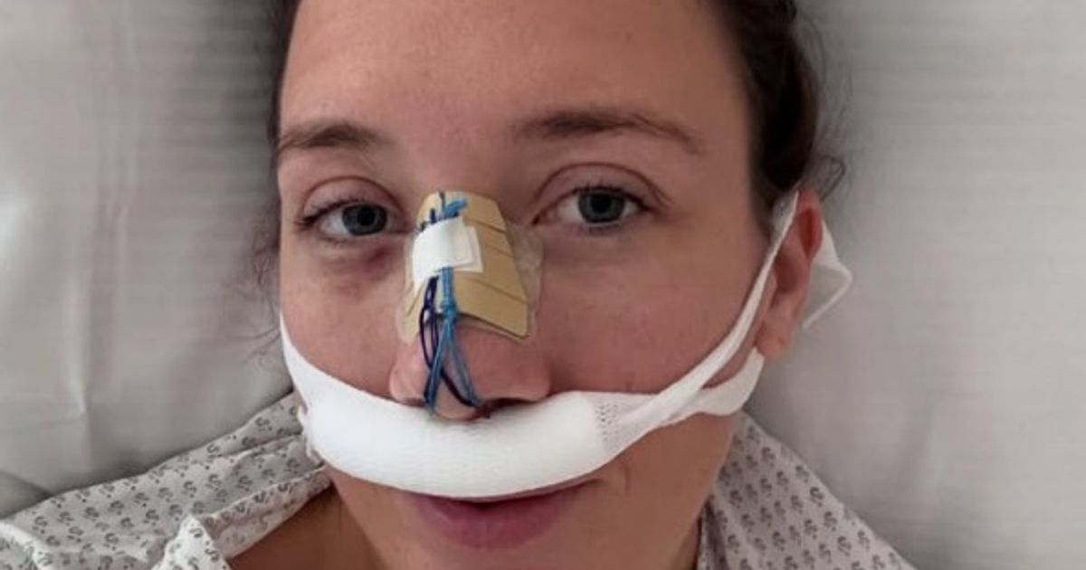 Face hits goal post: Ski star badly injured by fall during training