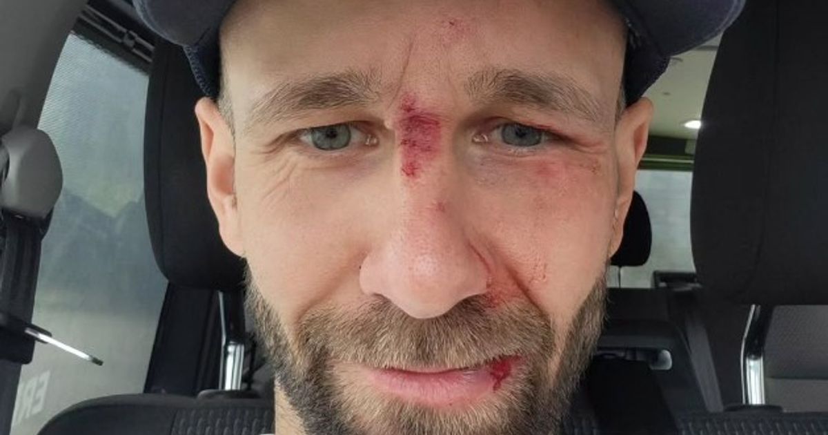 Ski jumping star has to take weeks off after fall at Bergisel