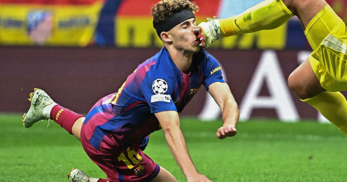 Schmerzhaftes-Aus-f-r-Barcelona-gegen-Atletico-PSG-nahm-H-rde-Liverpool